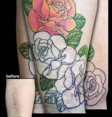 scar cover-up tattoo in progress by Tanya Magdalena
